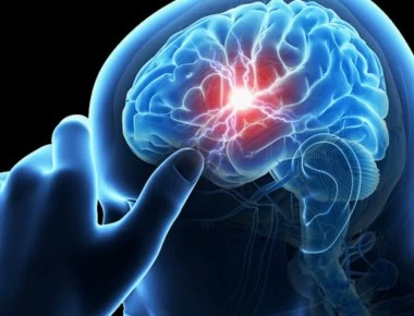 Τα σημάδια ενός μίνι εγκεφαλικού επεισοδίου